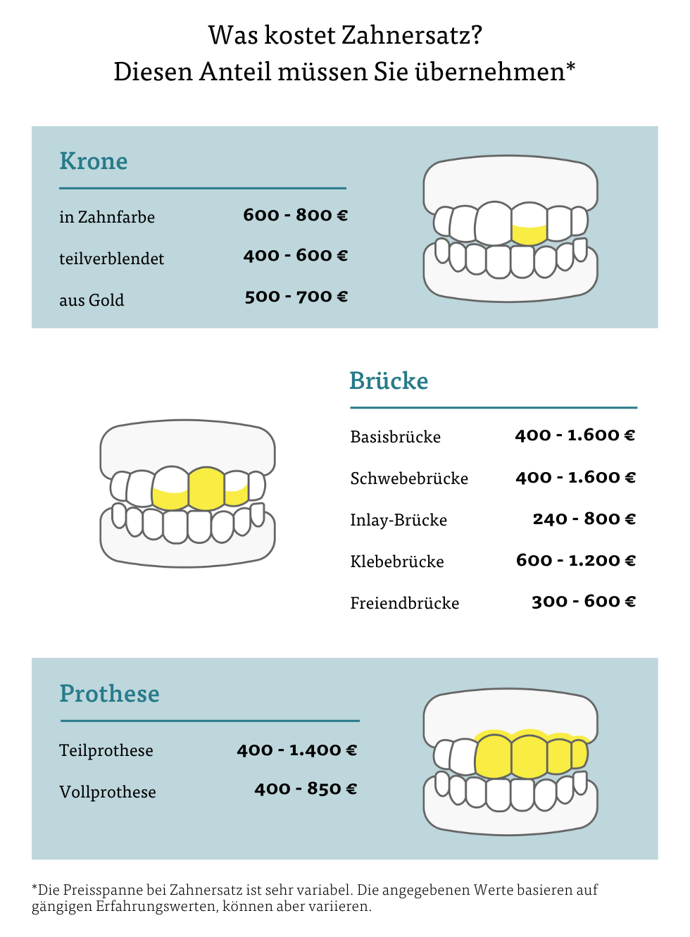 Was kostet Zahnersatz? Diesen Anteil müssen Sie übernehmen Was kostet Zahnersatz? Diesen Anteil müssen Sie übernehmen
