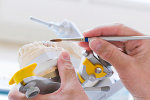 Die Kosten für Zahnbrücken und wer sie übernimmt Die Kosten für Zahnbrücken und wer sie übernimmt